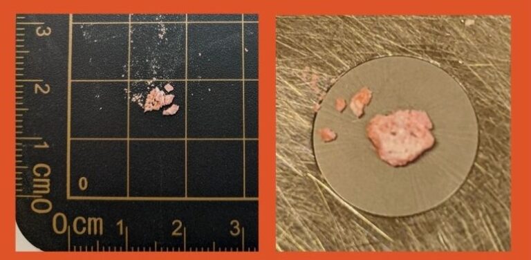 Drug alert issued for Cranbrook